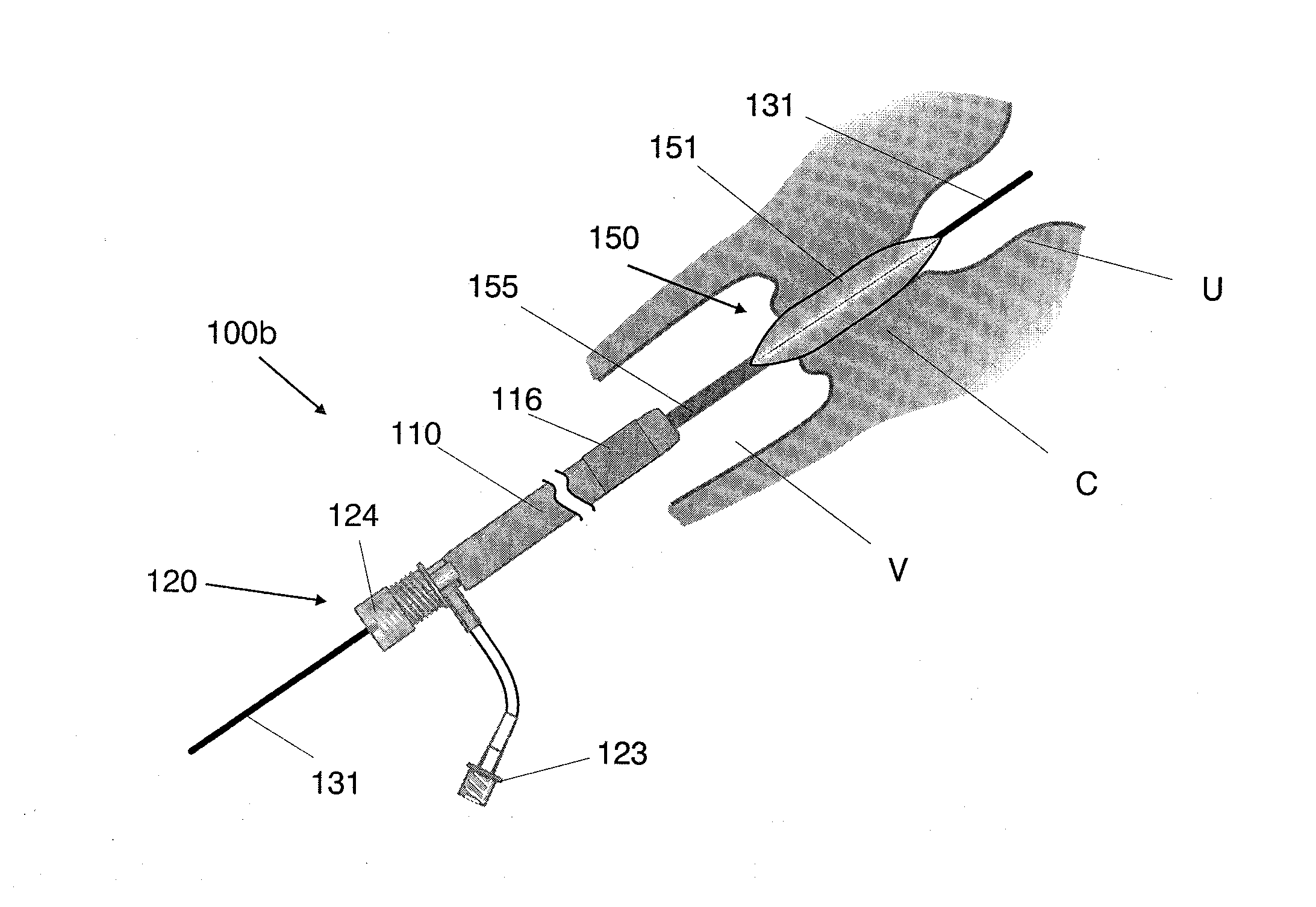 Systems for performing gynecological procedures with mechanical distension