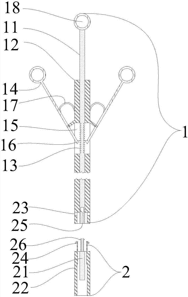 Two-section rod for removing object from abdominal cavity