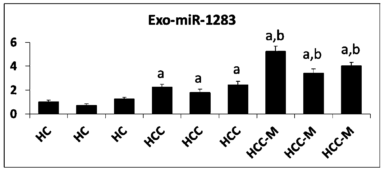 Application of exosome miRNA to preparation of liver cancer diagnosis products