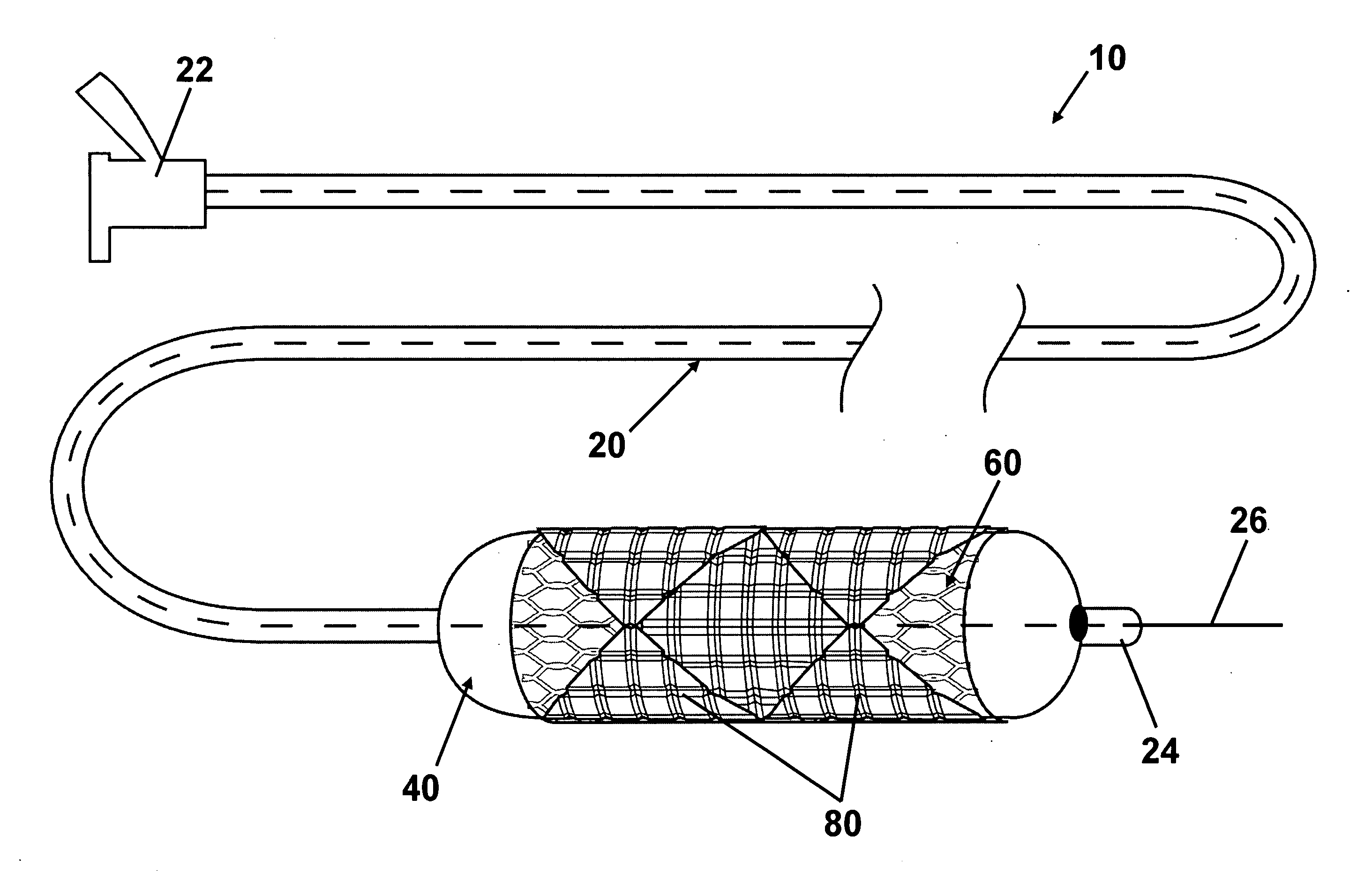Intraluminal stent including therapeutic agent delivery pads, and method of manufacturing the same