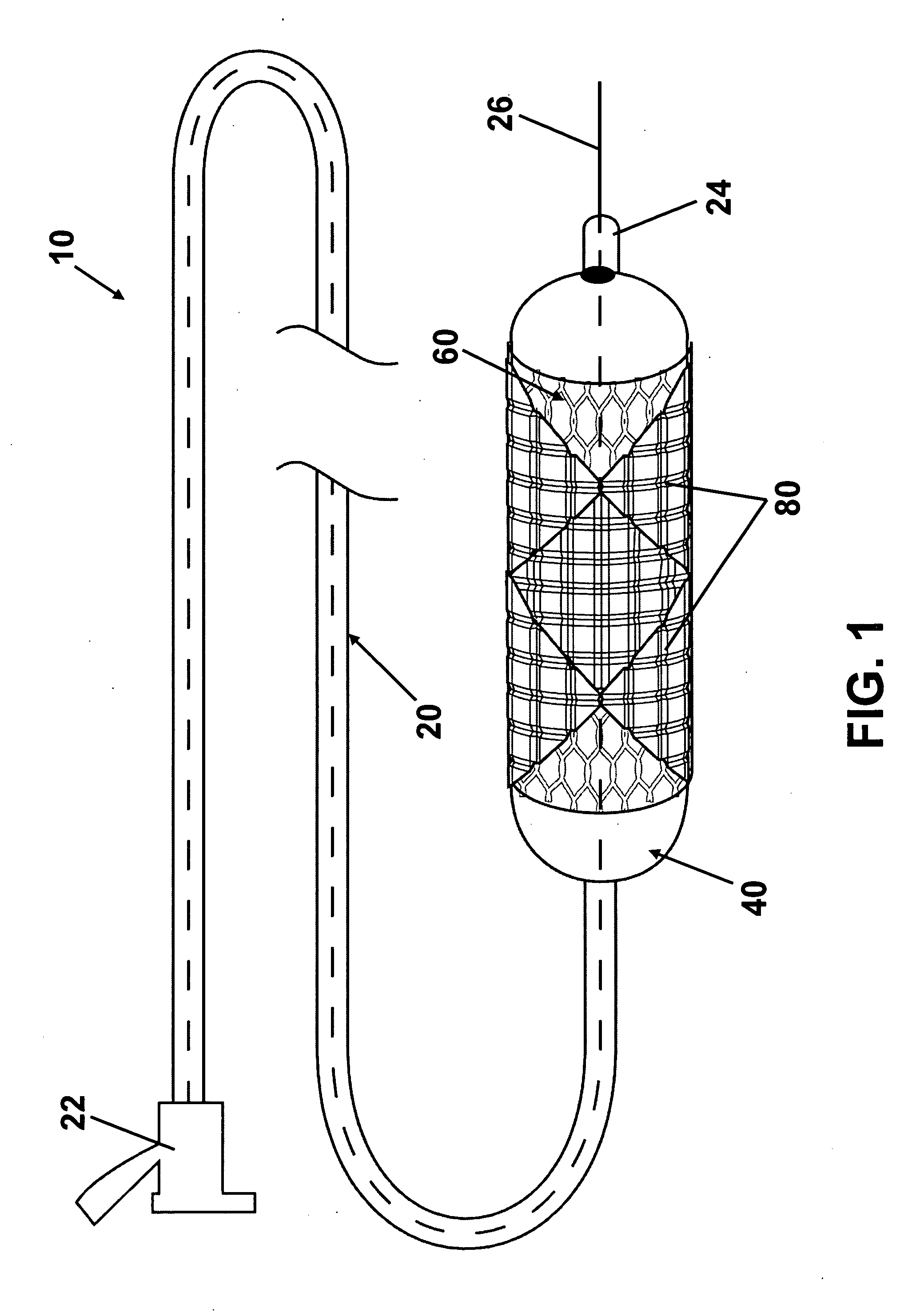 Intraluminal stent including therapeutic agent delivery pads, and method of manufacturing the same