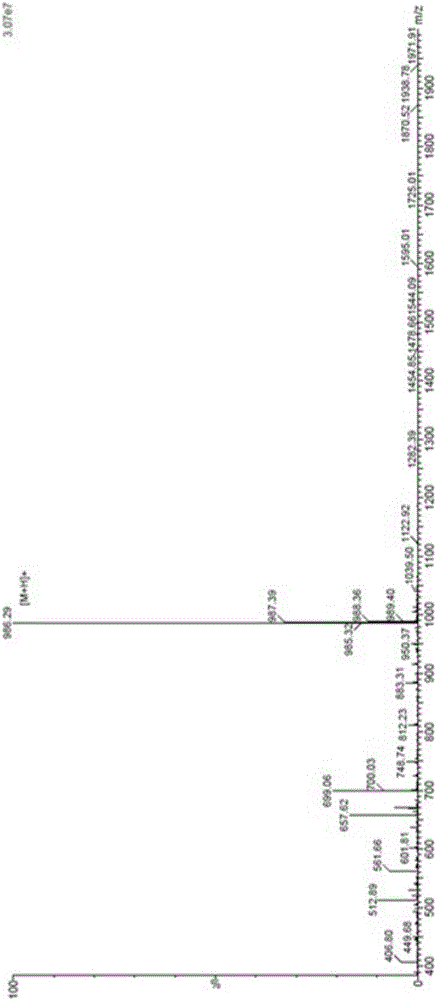 CTL epitope peptide of tumor antigen PSA (prostate specific antigen) and application of CTL epitope peptide