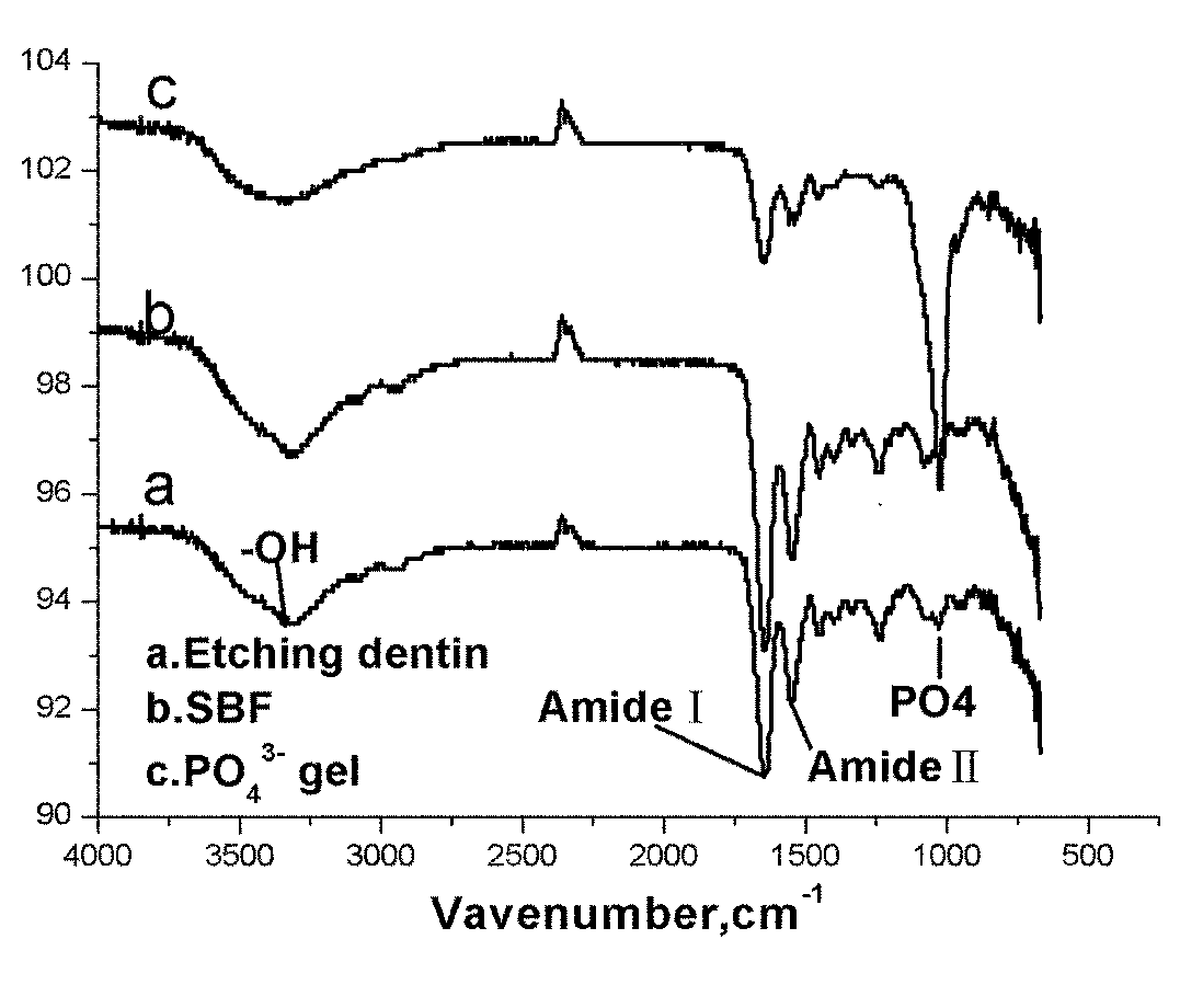 Method for in-vitro induction of remineralization of dentin