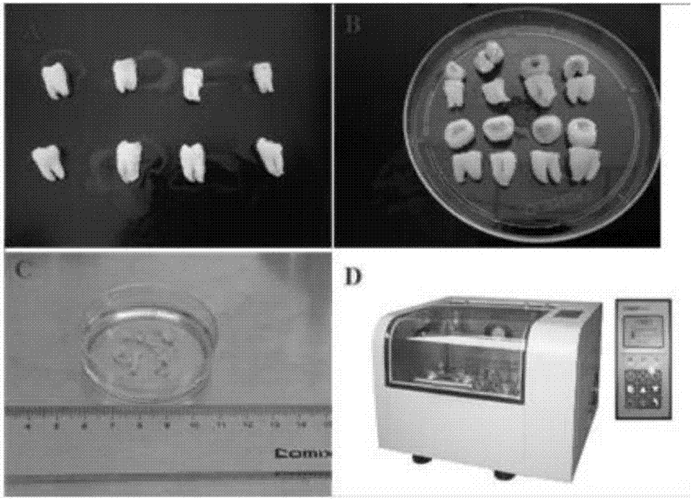 Method for preparing primary dental pulp stem cells and method for constructing dental pulp stem cell bank