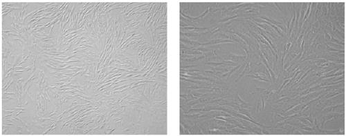 Method for inducing dental pulp stem cells (DPSCs) to be differentiated into cardiomyocyte-like cells