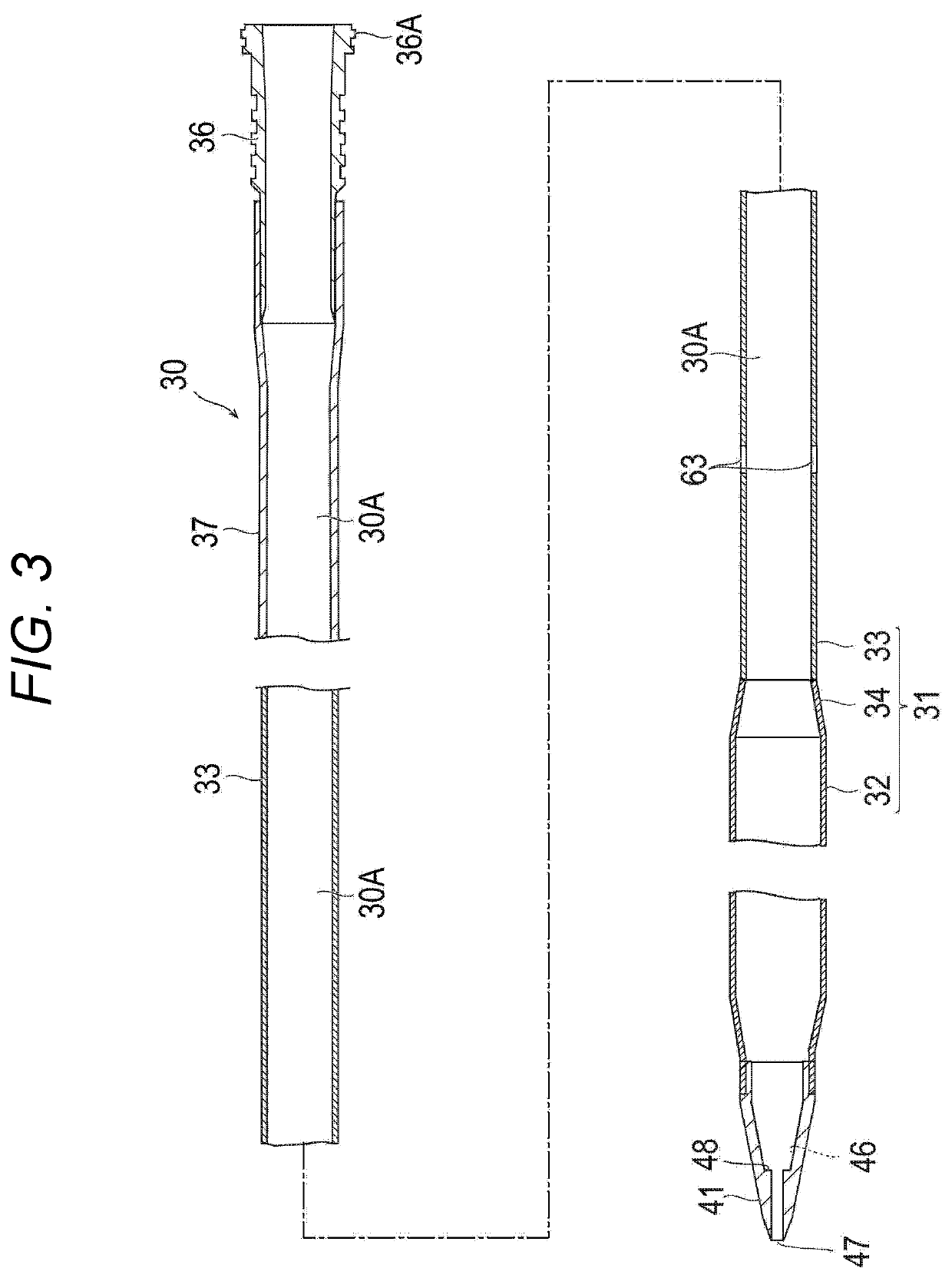 Percutaneous catheter