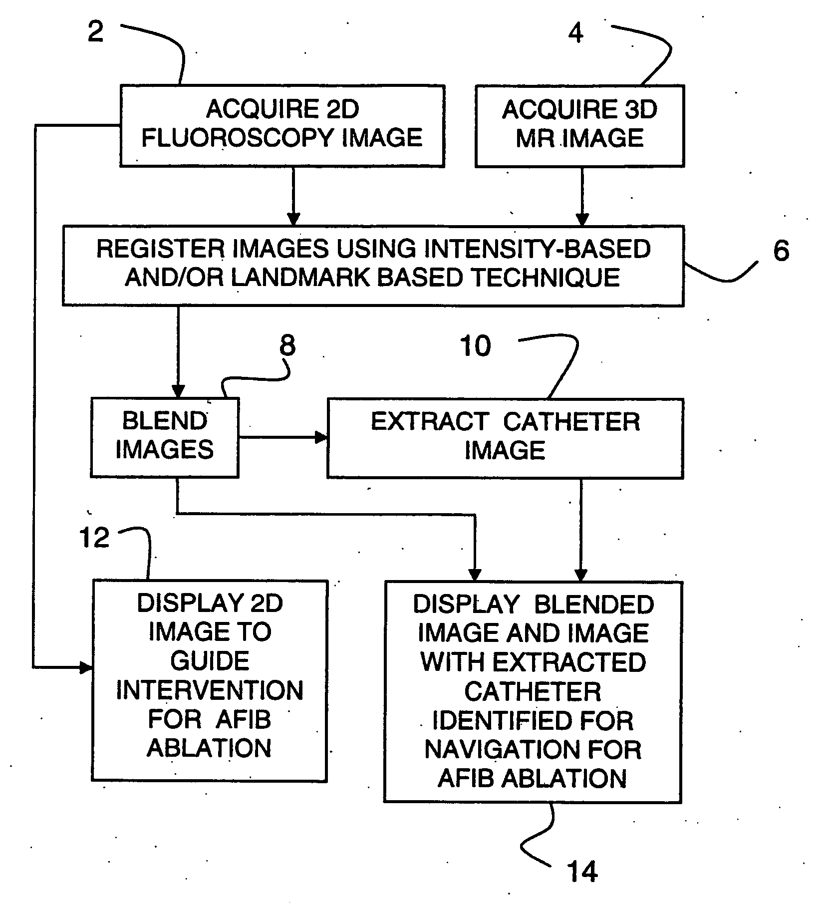 Method and system for cardiac imaging and catheter guidance for radio frequency (RF) ablation
