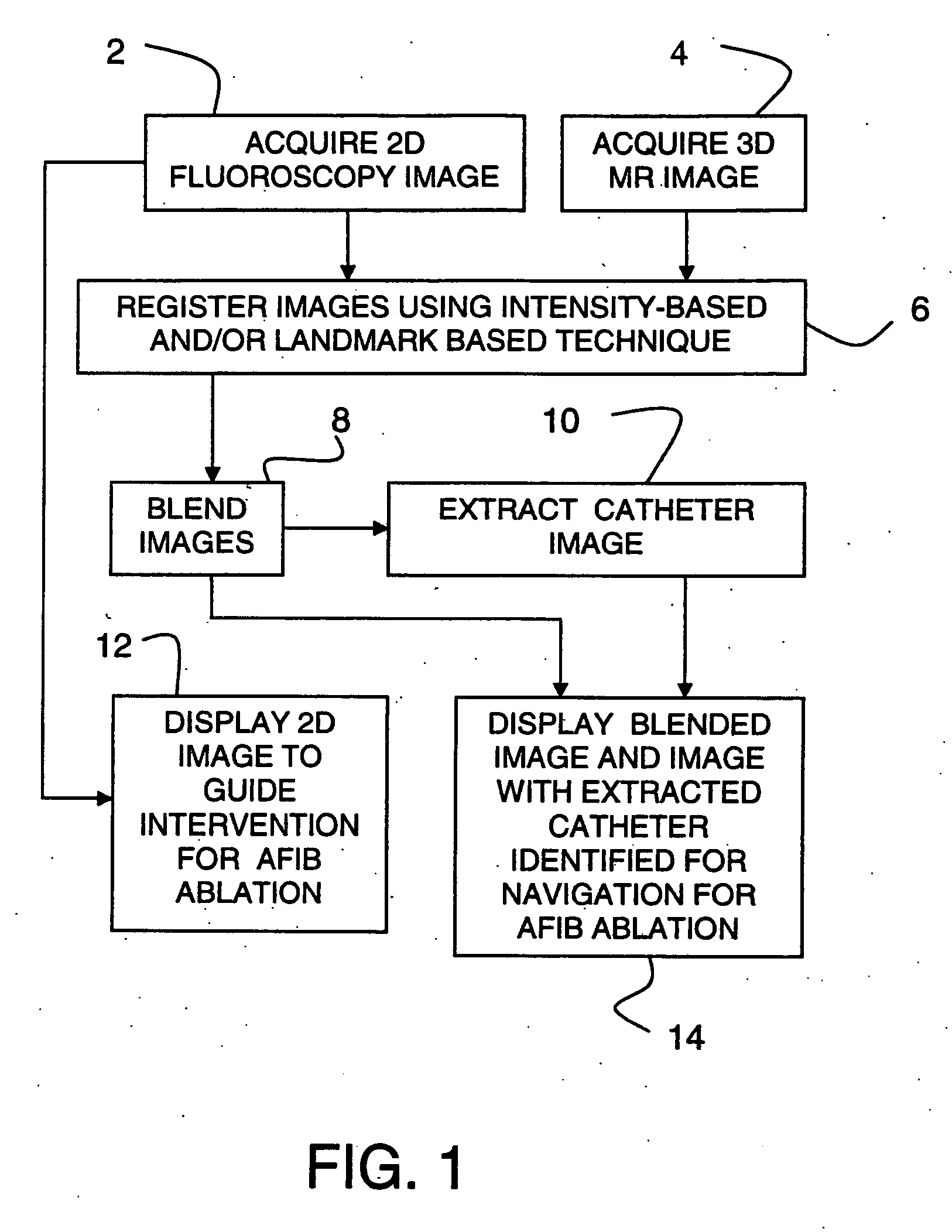 Method and system for cardiac imaging and catheter guidance for radio frequency (RF) ablation