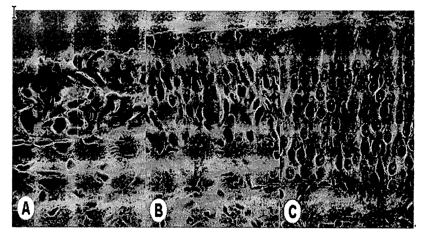 Composition for treating or preventing olfactory disorder