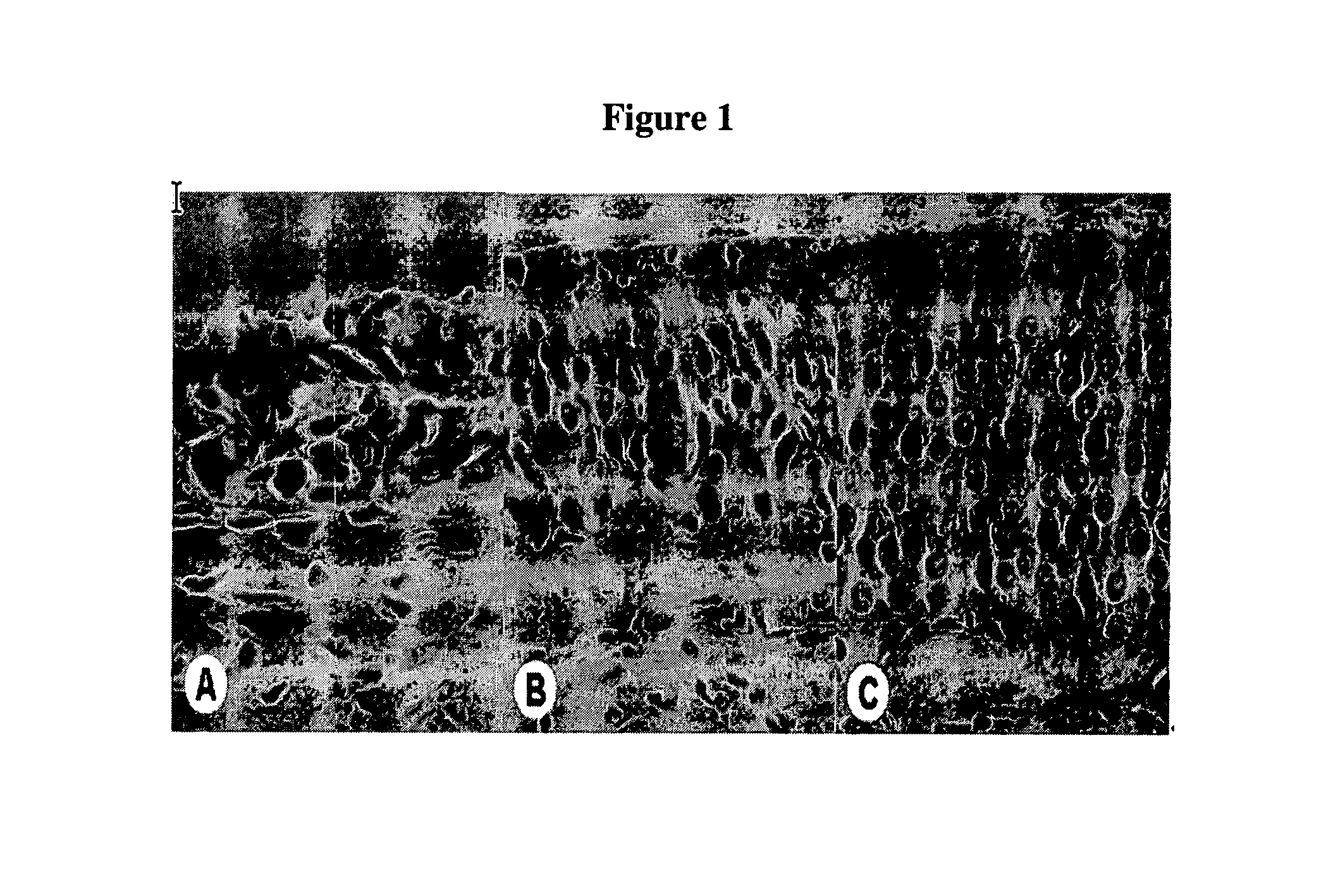 Composition for treating or preventing olfactory disorder