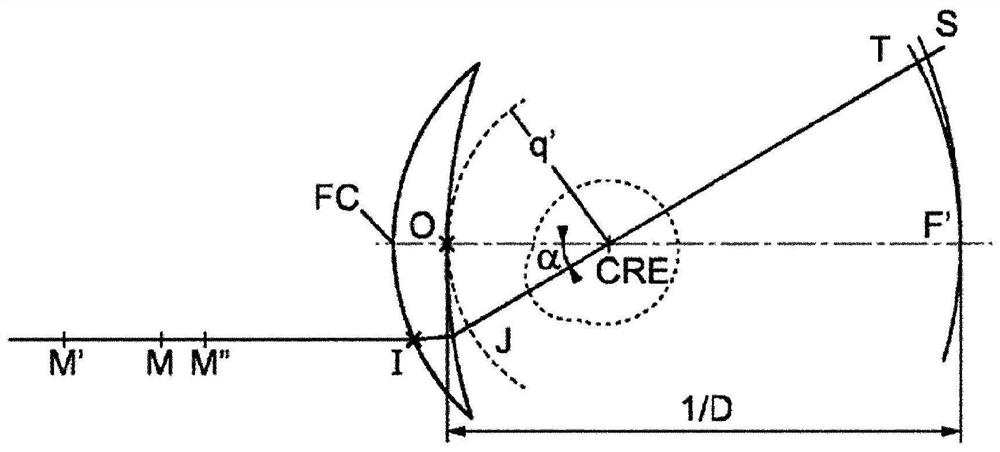 A progressive ophthalmic lens