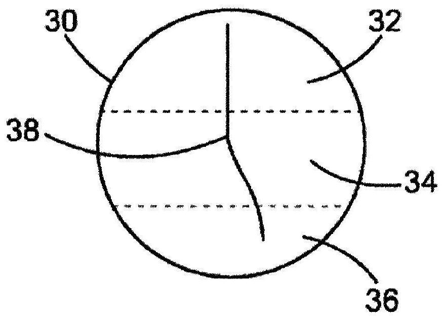 A progressive ophthalmic lens