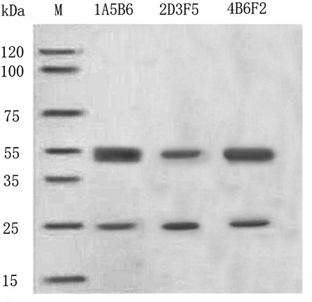 Hybridoma cell strain capable of secreting anti-Spondin1 monoclonal antibody as well as monoclonal antibody and application of monoclonal antibody