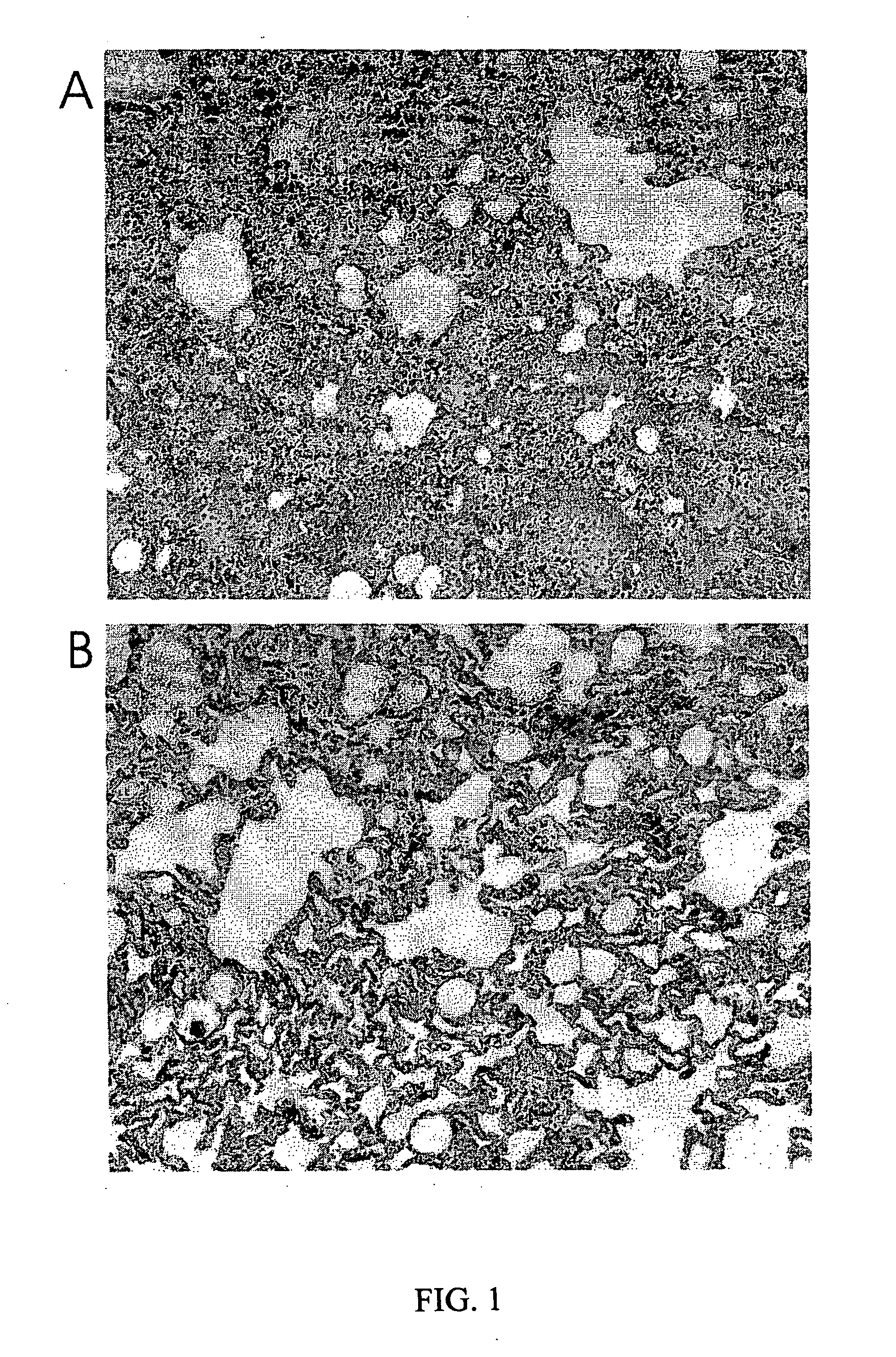 Method for treating or preventing ischemia reperfusion injury or multi-organ failure