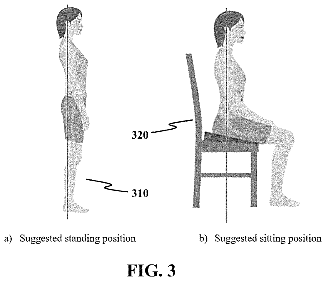 Biofeedback system with body mapping clothing for patients with adolescent idiopathic scoliosis