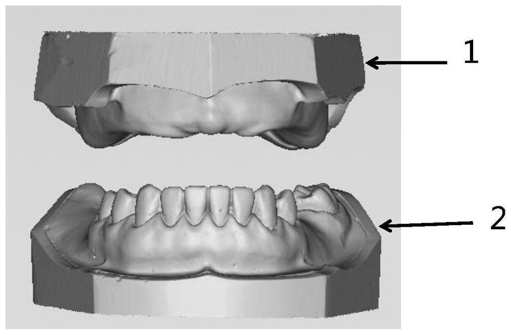 CAD/CAM digital manufacturing method of frame movable denture