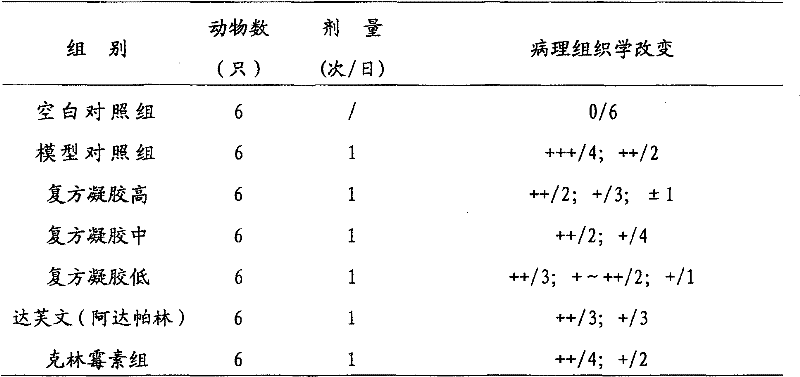 Adapalene and hydrochloric clindamycin compound gel preparation and preparation method thereof