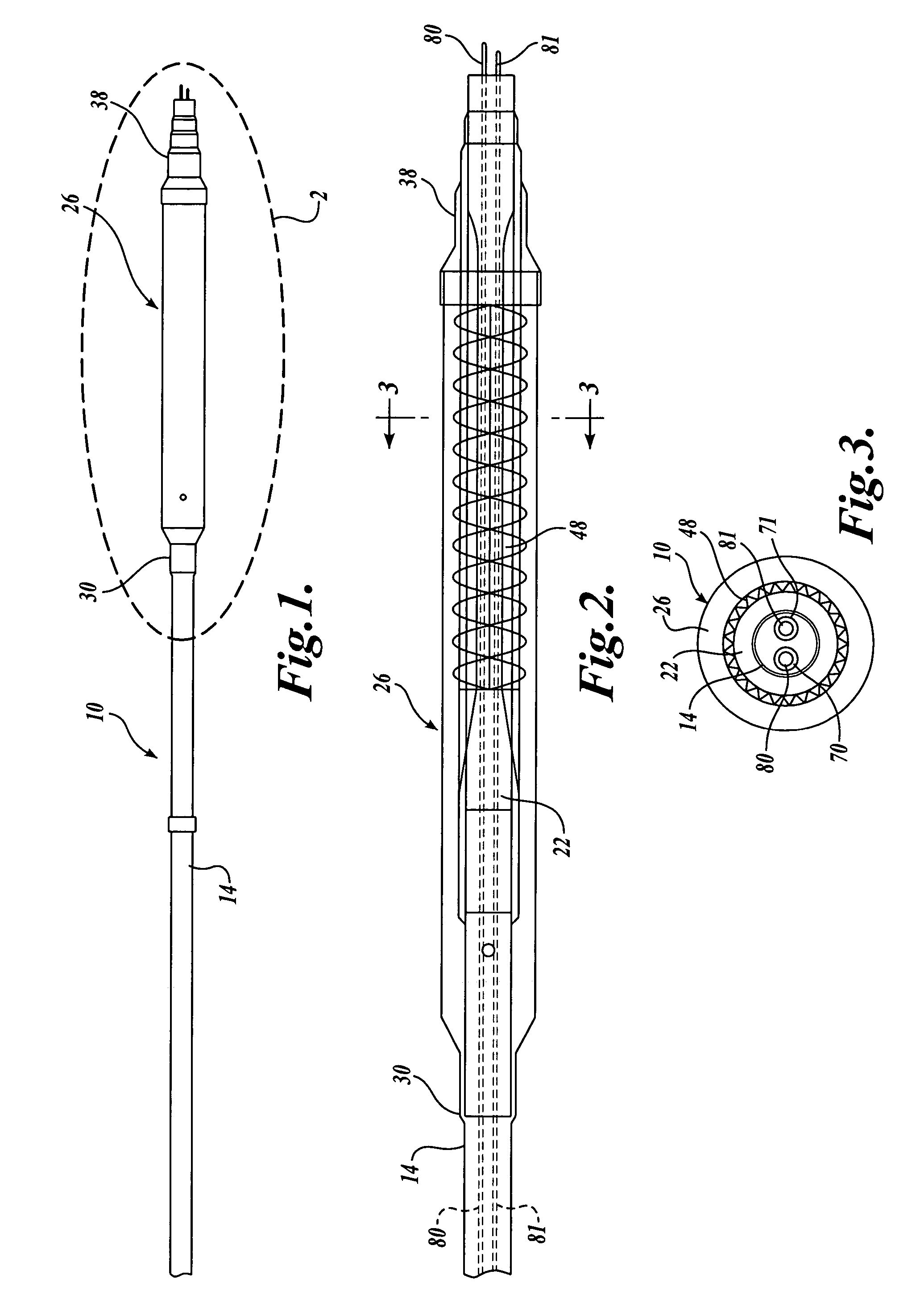 Stent delivery system with imaging capability