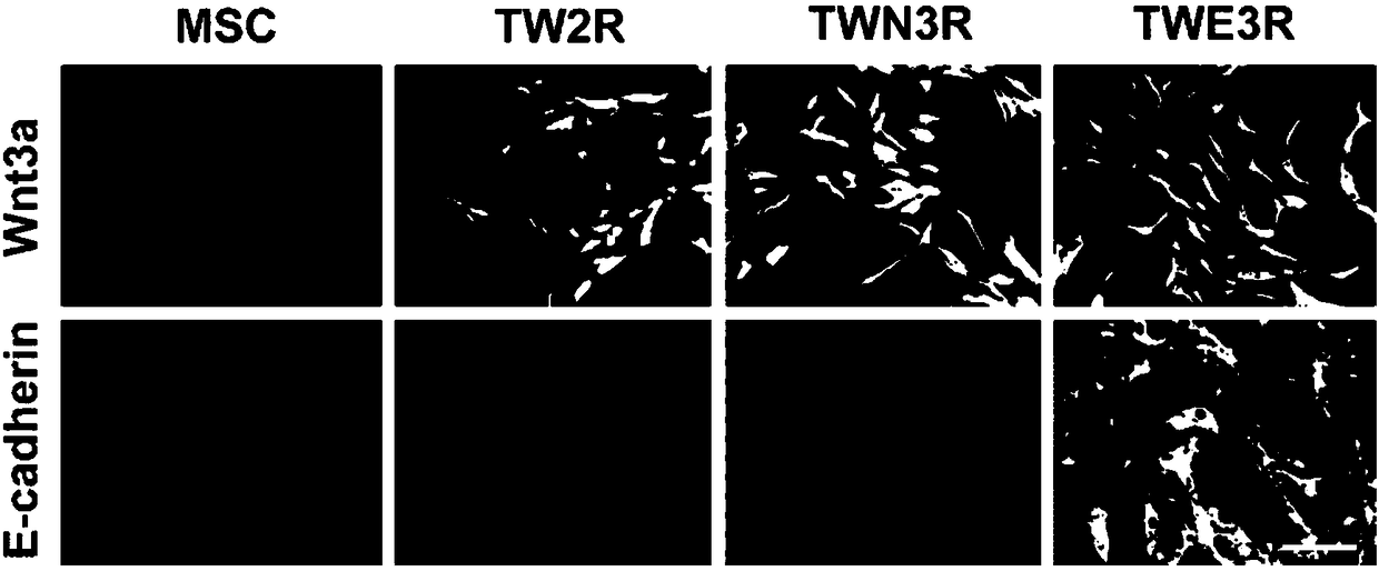 Preparation method of human embryonic stem cell growth-supporting humanized feeder layer cell