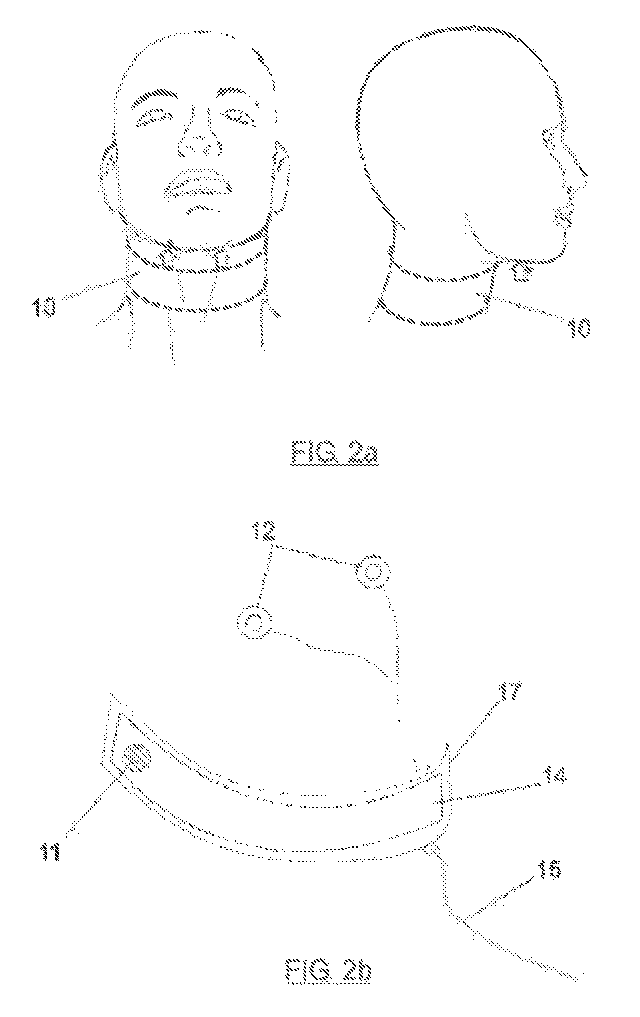 Electrostimulation method and system for the treatment of sleep apnea