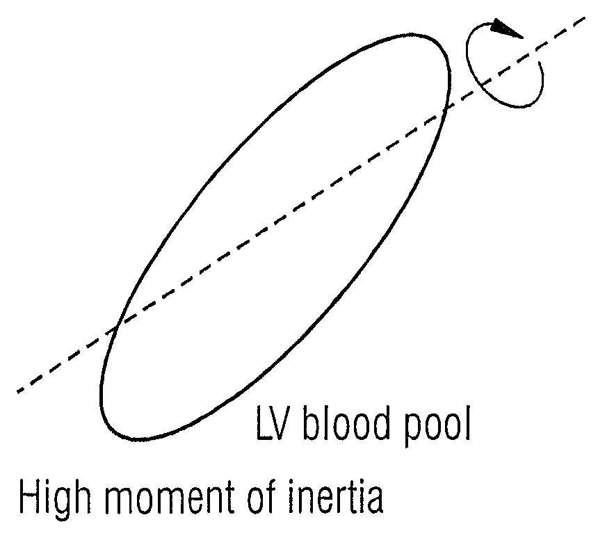 Reorientation of cardiac images