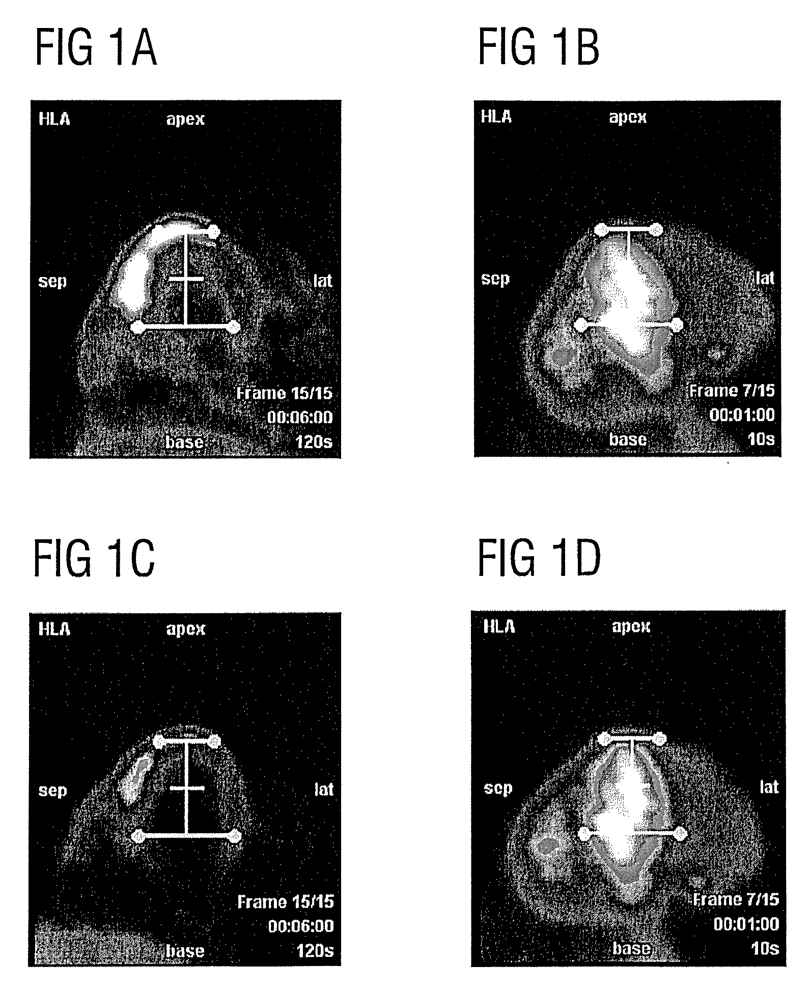 Reorientation of cardiac images