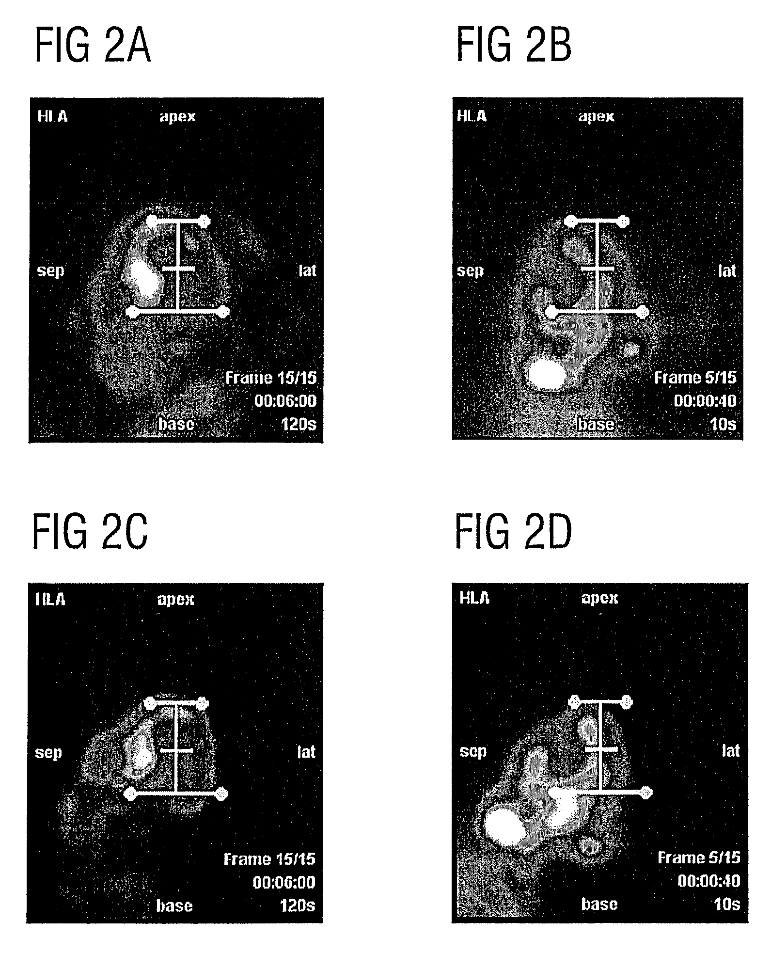 Reorientation of cardiac images