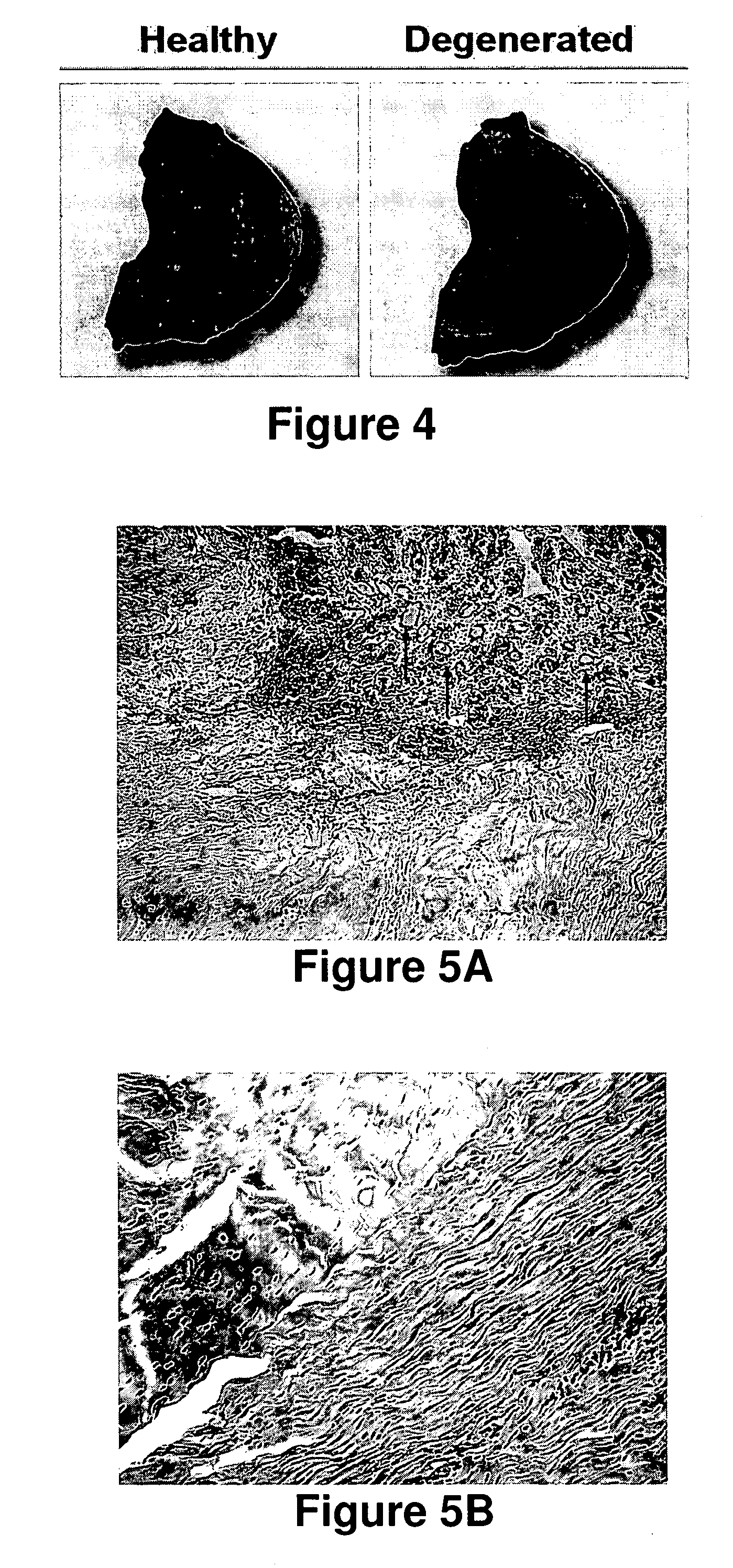 Surgical staples and methods of use thereof