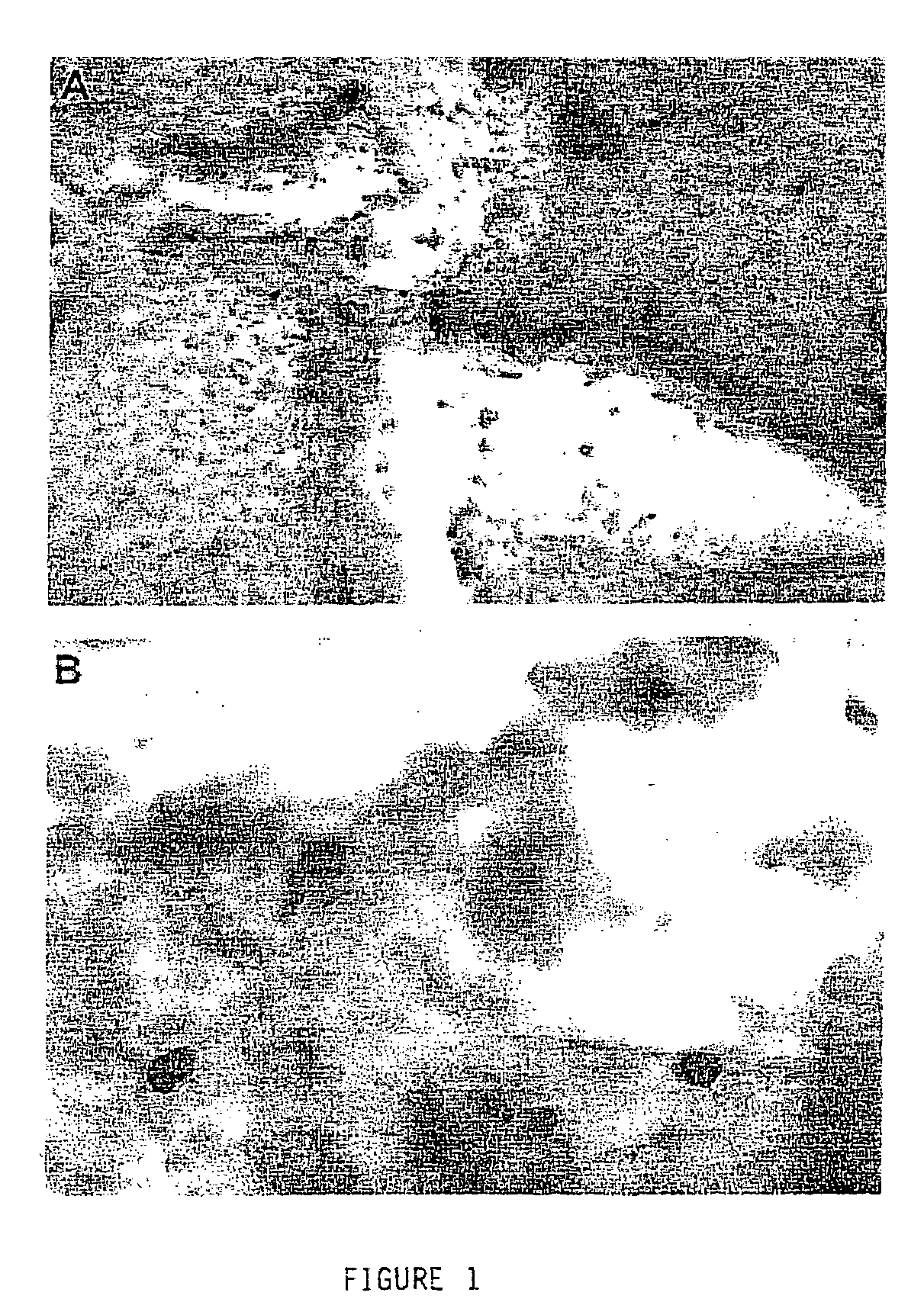 Corneal cells expressing active agents and methods of use thereof