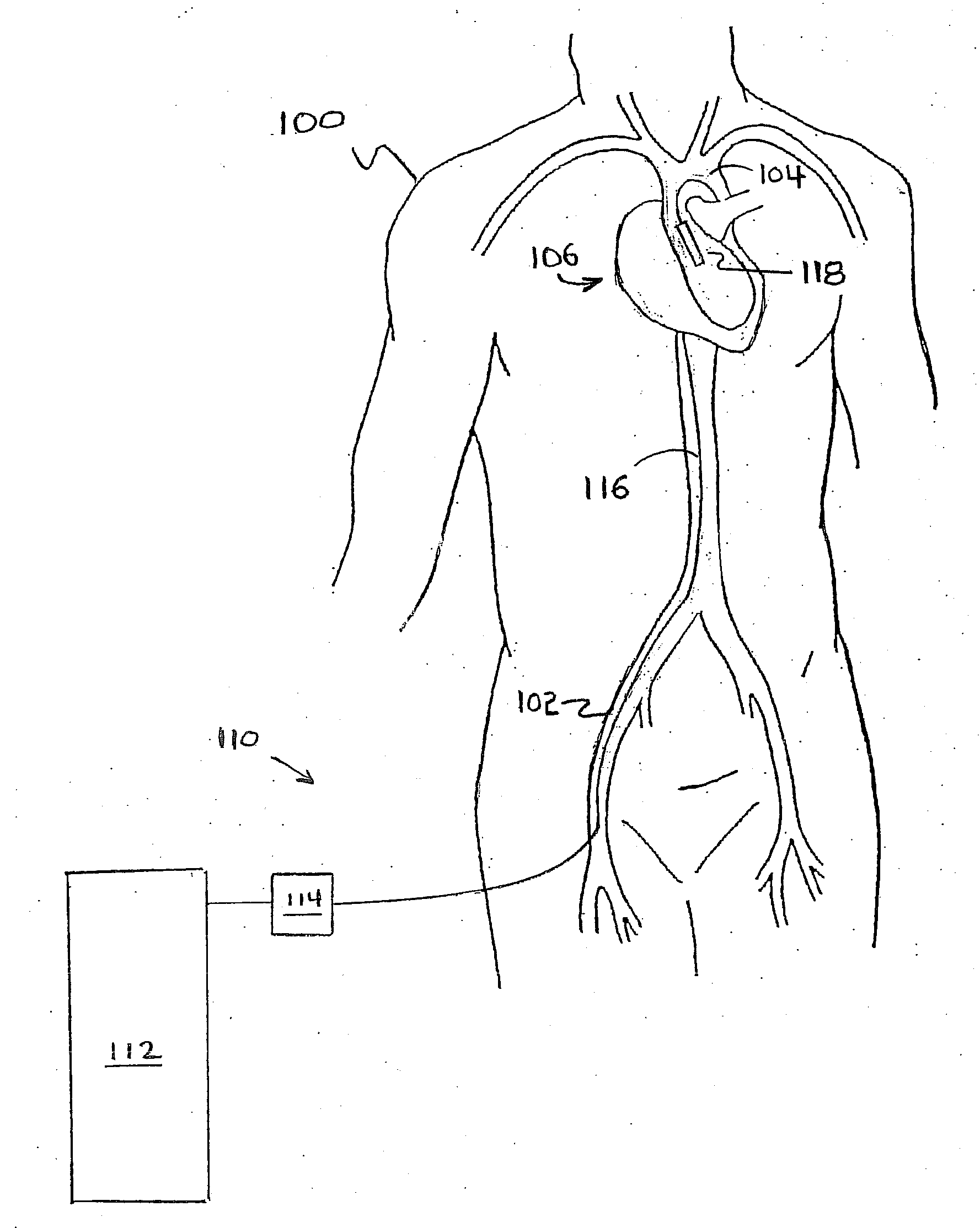 Method for Deployment of a Medical Device