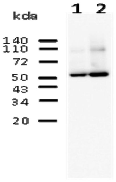 A kind of monoclonal antibody for detecting cabbage catalase and its application