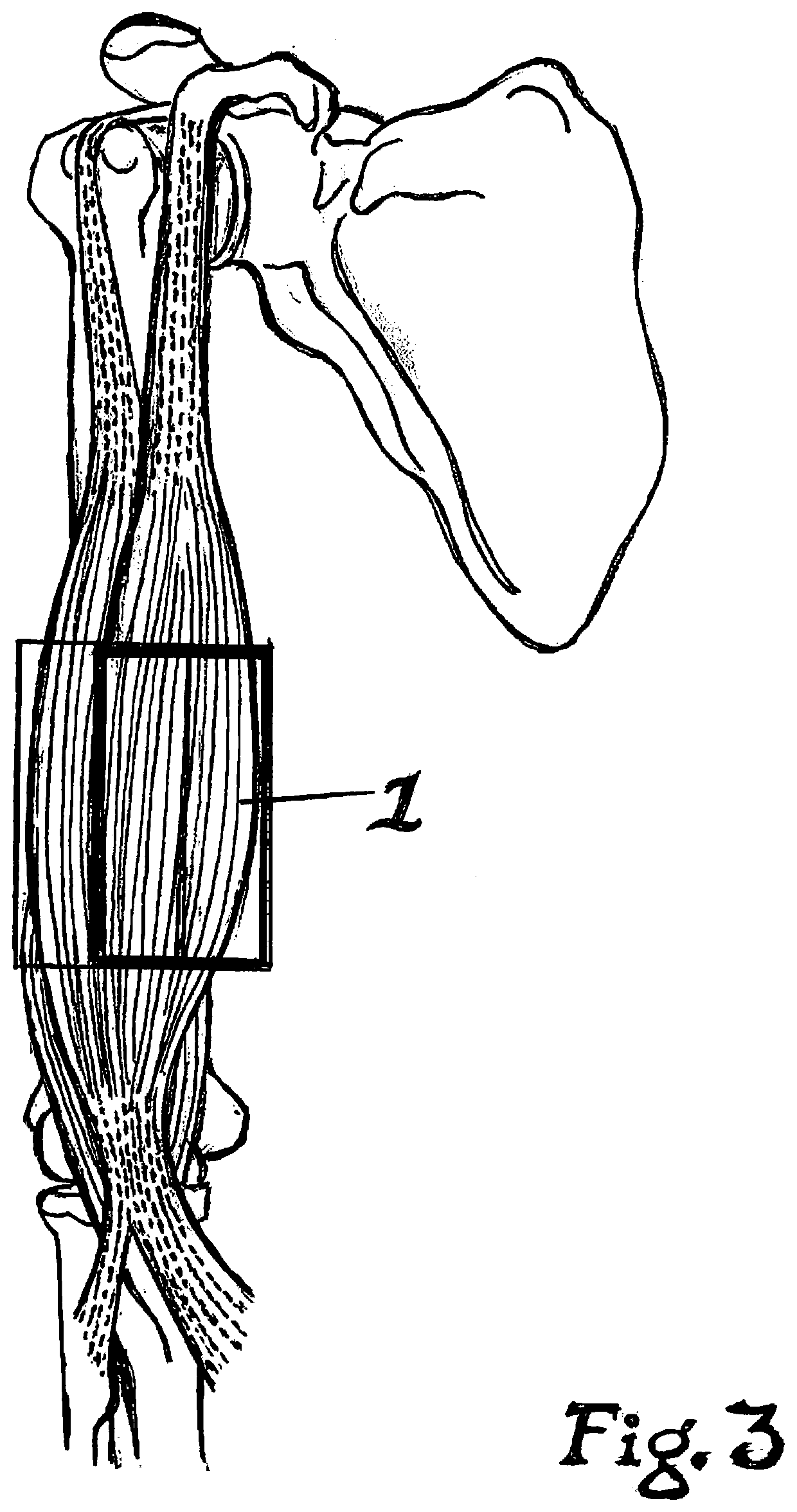 Taping Method for Elicitation of Skeleton Muscle Tone