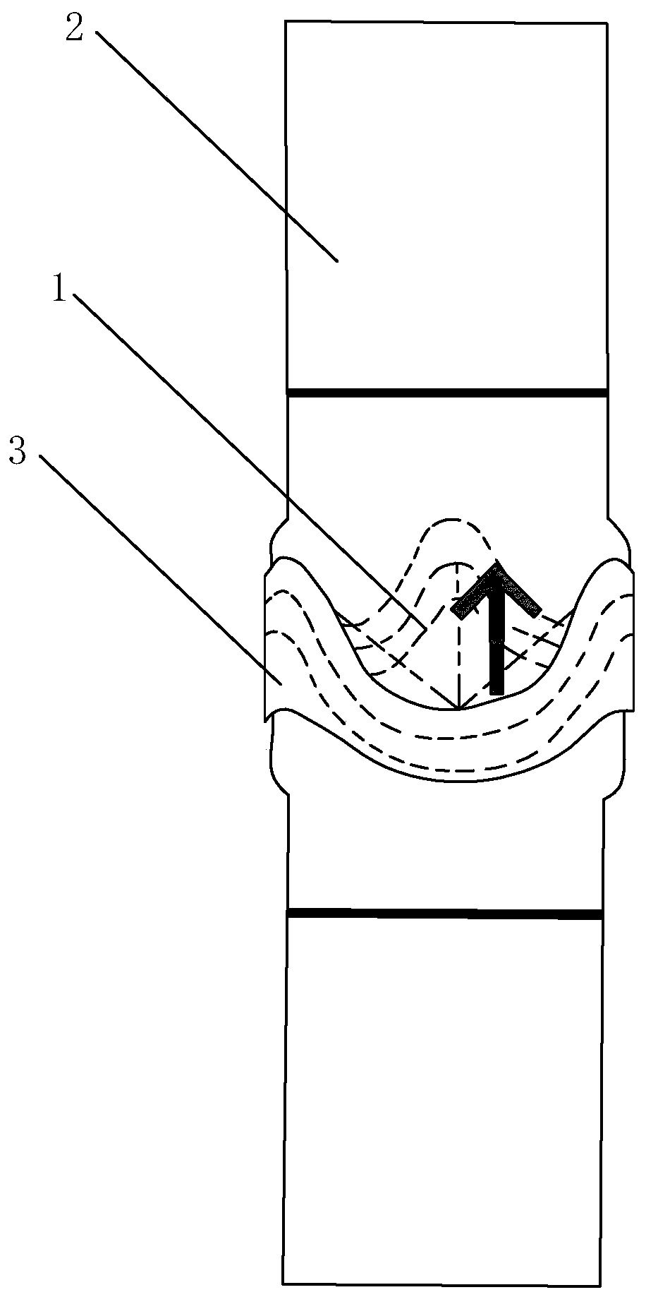 Artificial valved blood vessel