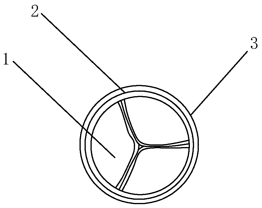 Artificial valved blood vessel