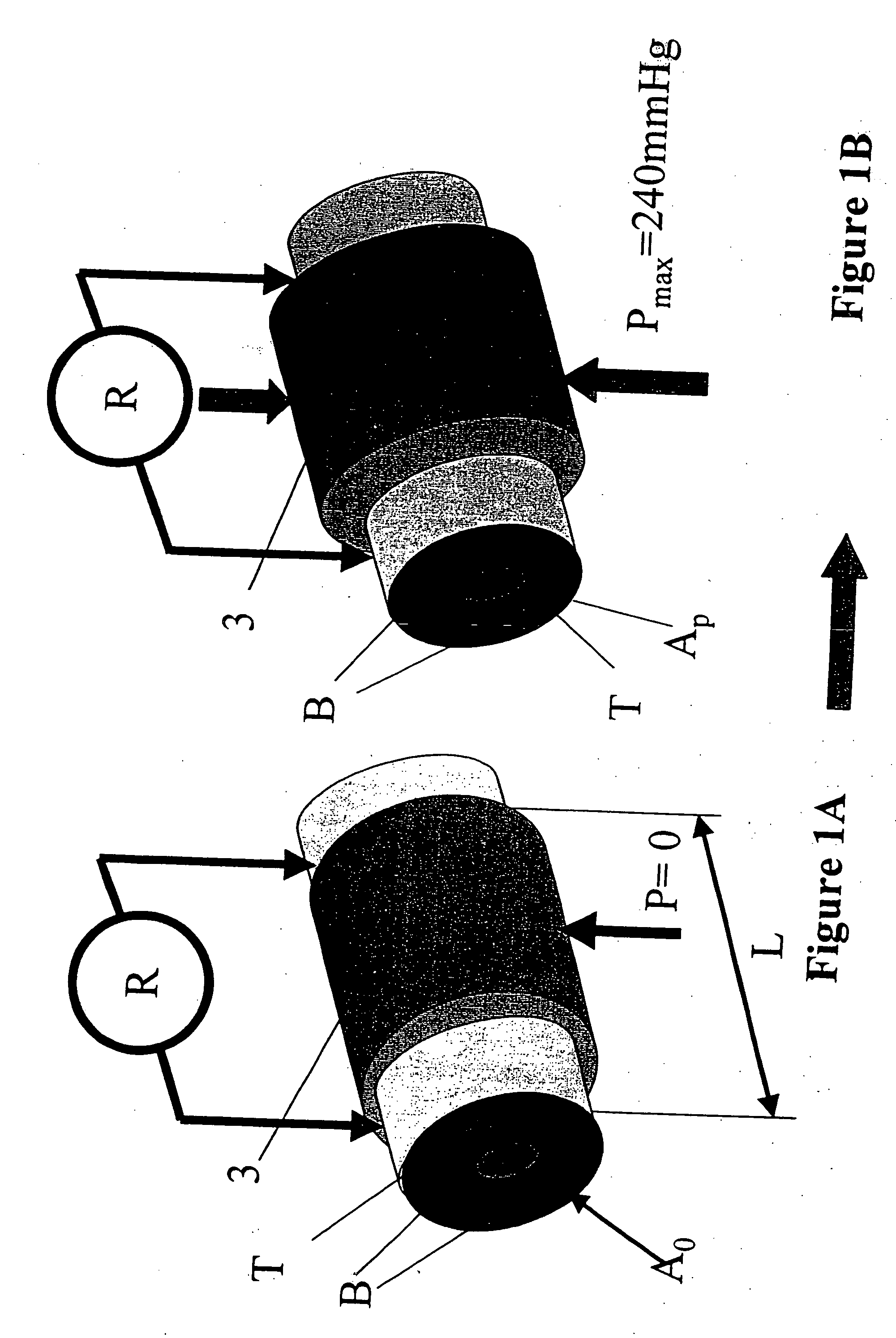 Device and method for the determination of dry weight by continuous measurement of resistance and calculation of circumference in a body segment using segmental bioimpedance analysis