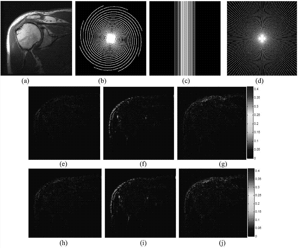 Magnetic resonance super undersampled K data imaging method based on studying generalized double-layer Bergman non-convex-type dictionary