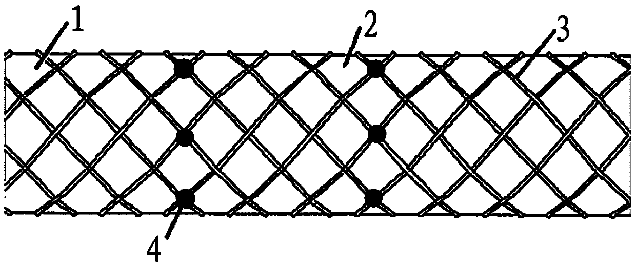 Iliac vein stent