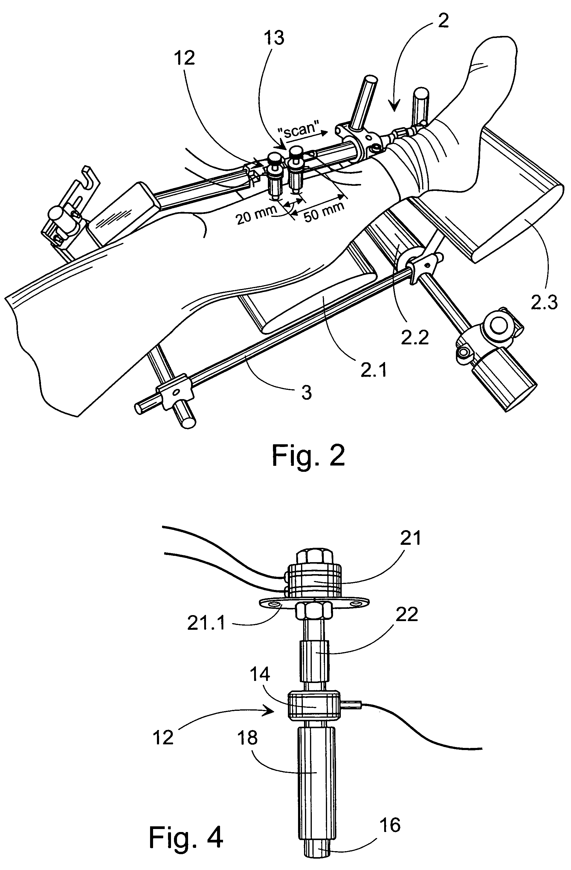 Method and device for the non-invasive assessment of bones