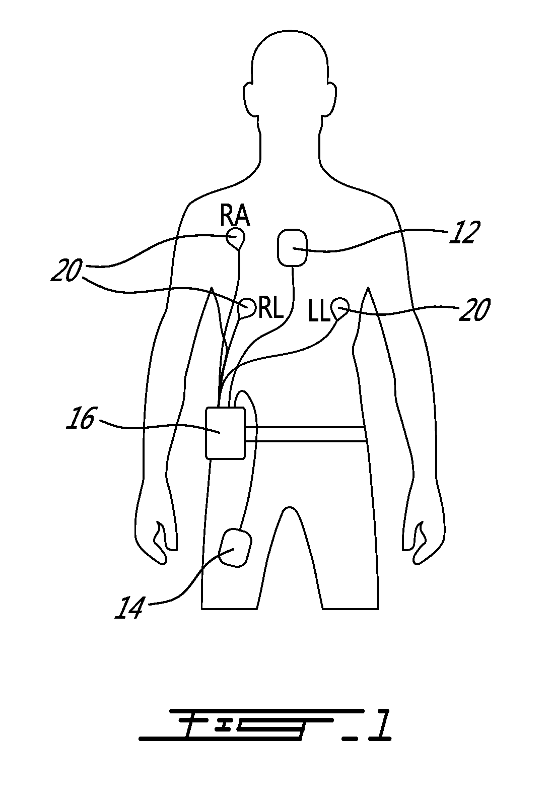 Activity, posture and heart monitoring system and method