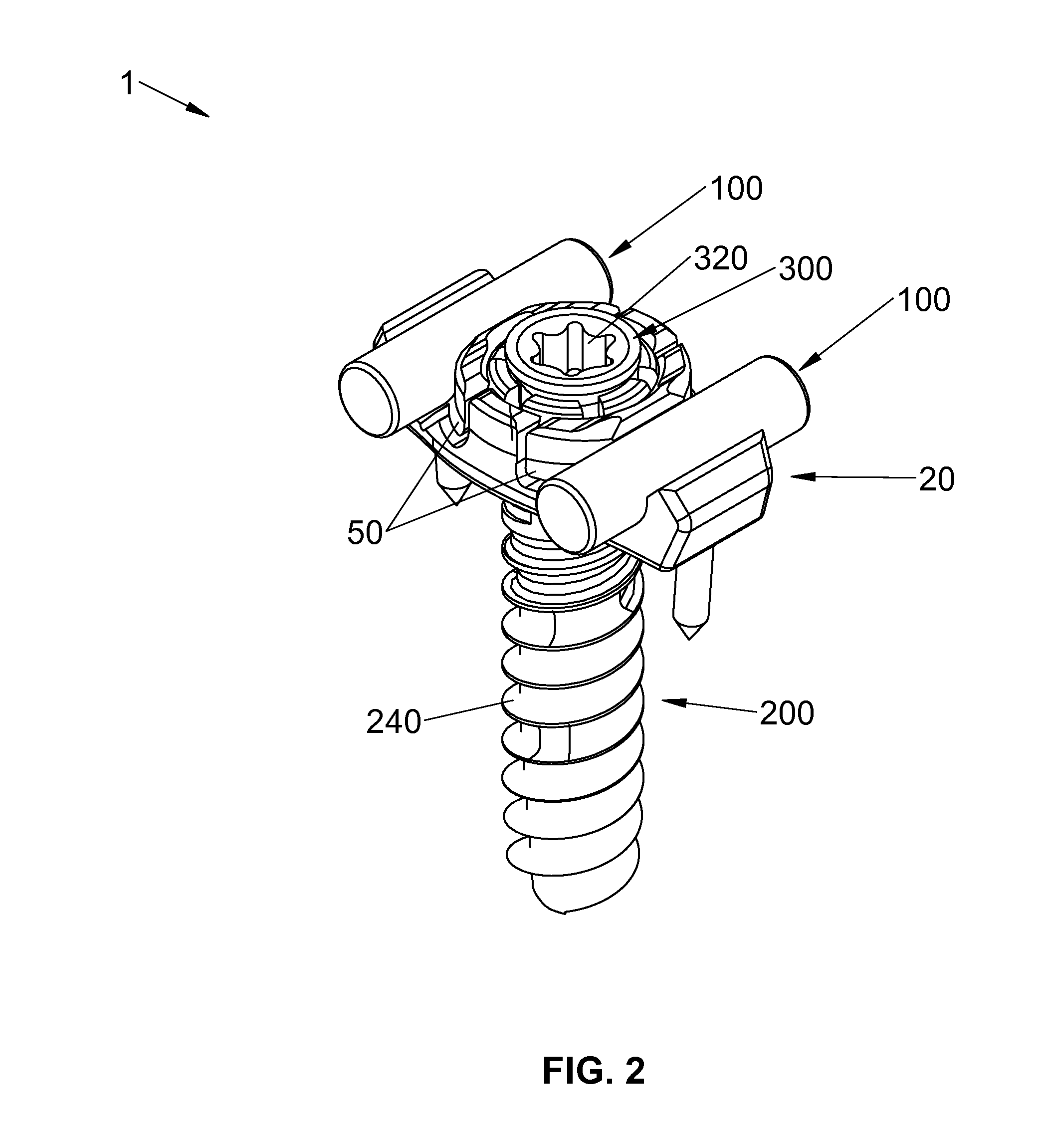 Spinal stabilization system