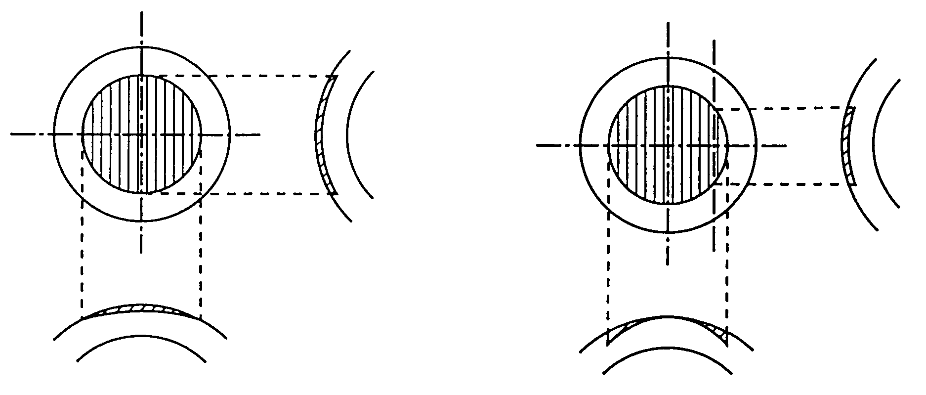 Method for calculating refractive correction amount in corneal refractive surgery