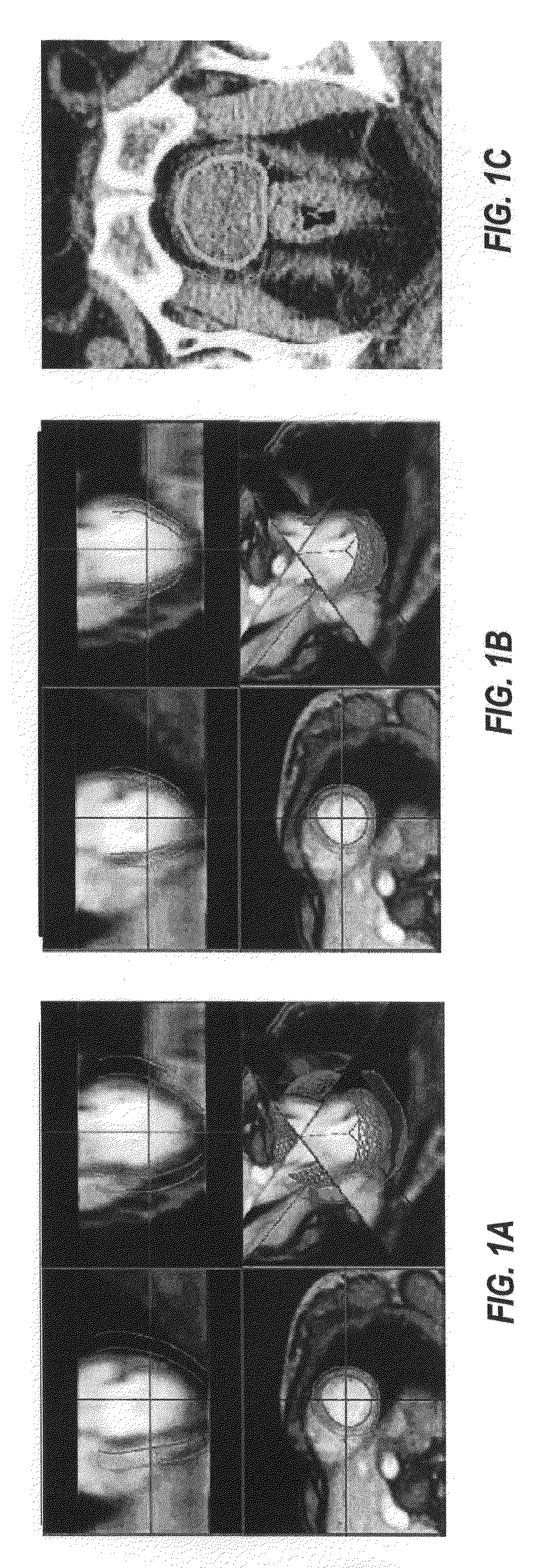 System and methods for image segmentation in N-dimensional space