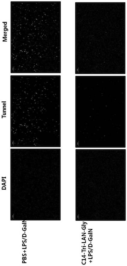 A drug for preventing and treating fulminant hepatitis