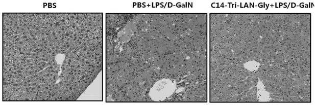 A drug for preventing and treating fulminant hepatitis