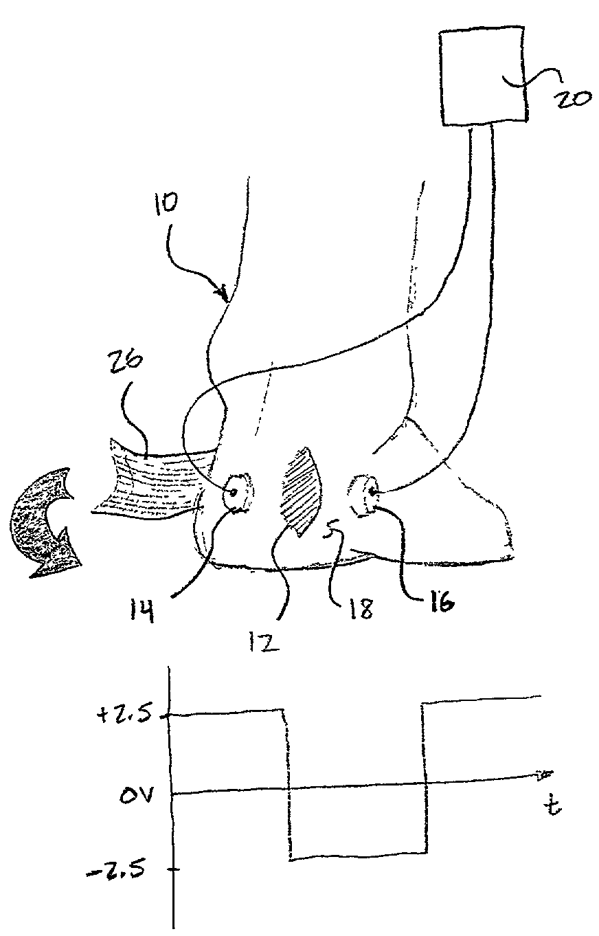 Non-invasive capacitively coupled electrical stimulation device for treatment of soft tissue wounds