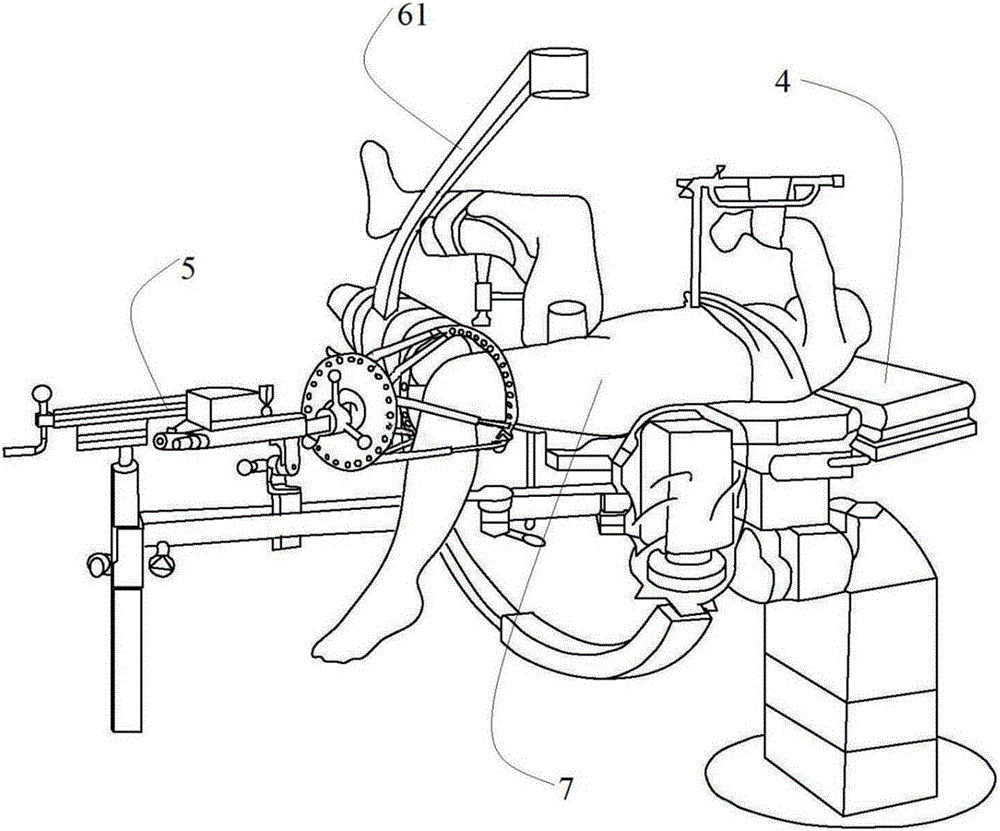 Master-slave mode parallel robot system and method for femoral shaft fracture reduction