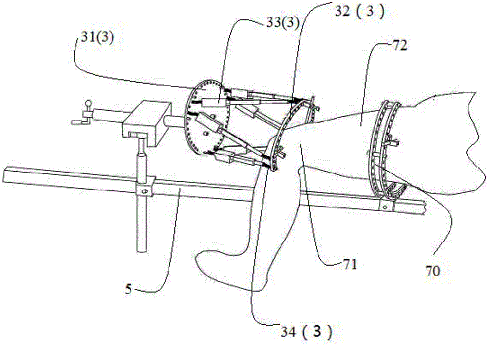 Master-slave mode parallel robot system and method for femoral shaft fracture reduction