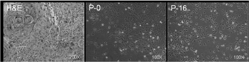 Chinese tongue squamous epithelial cell carcinoma cell line CTSC-2 and establishment method thereof