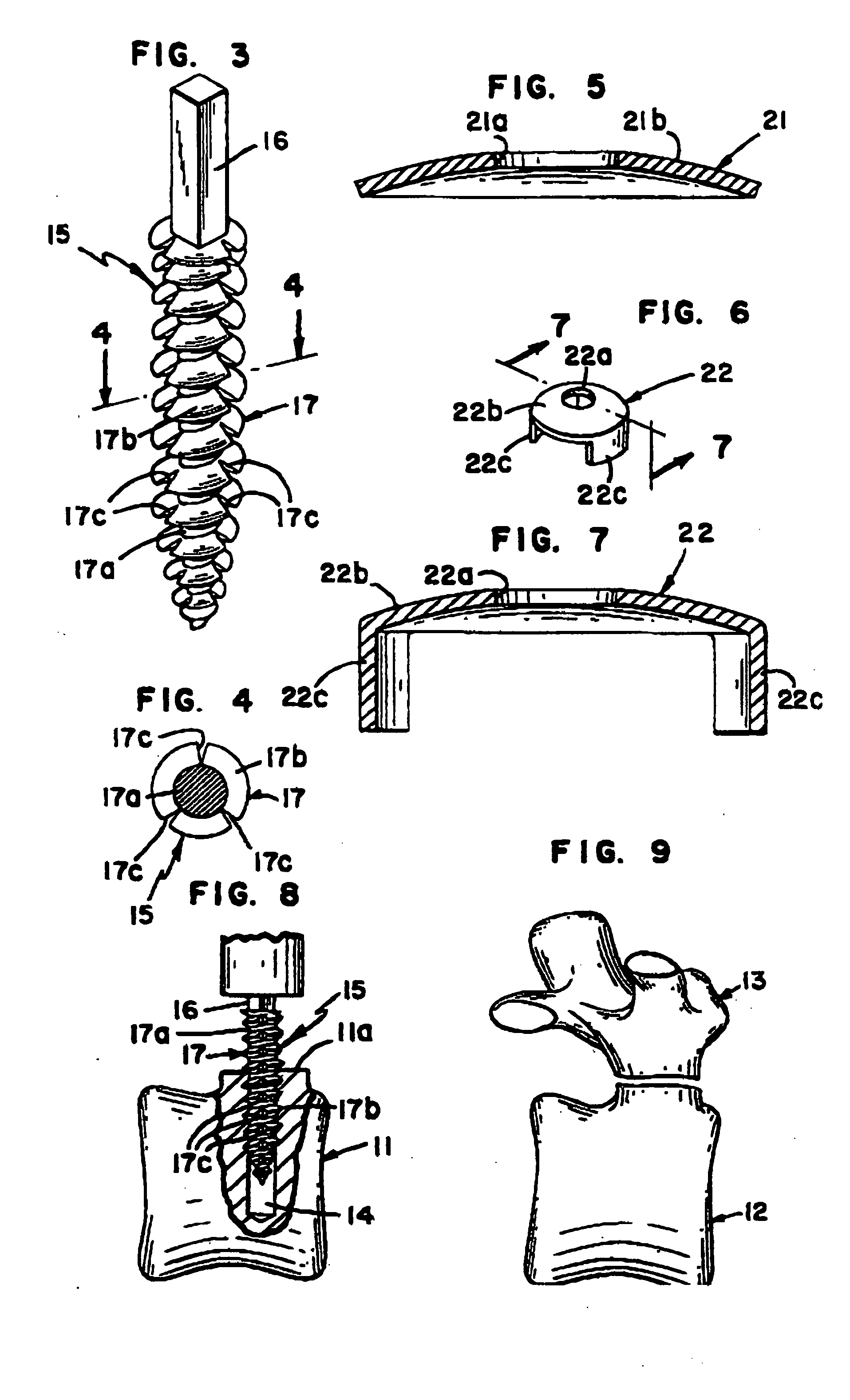 Integral flexible spine stabilization device and method