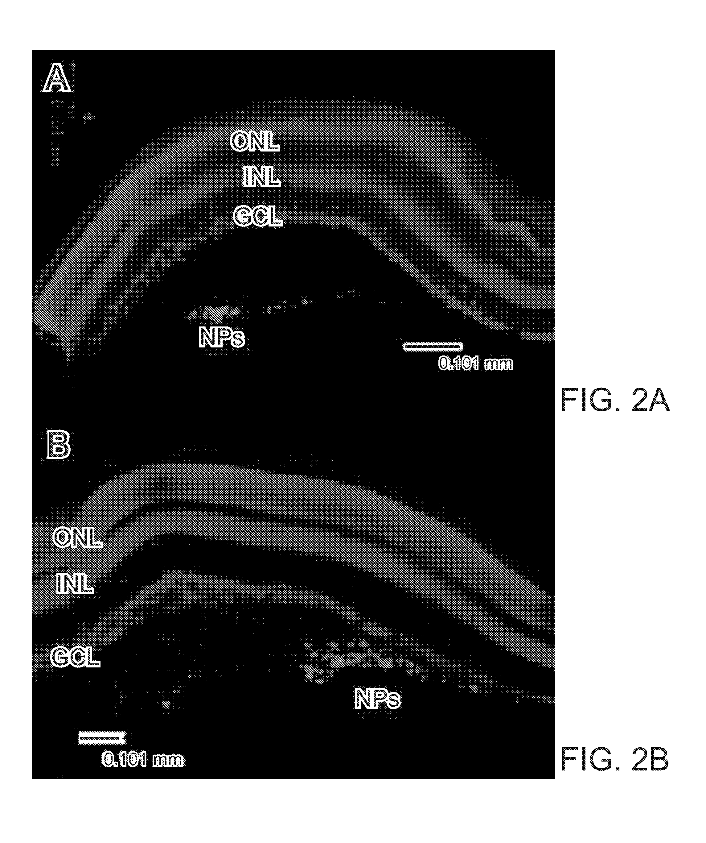 Nanoparticle composition and methods to make and use the same